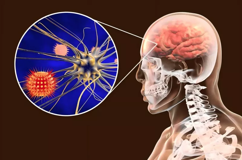 ຄູ່ມືການໃຫ້ວັກຊີນ Meningococcal ຄູ່ມືການໃຫ້ວັກຊີນ Meningococcal